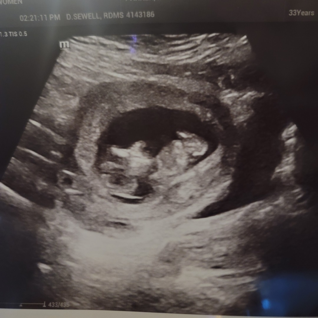 Photo shared by Sarah for their Babylist baby registry.