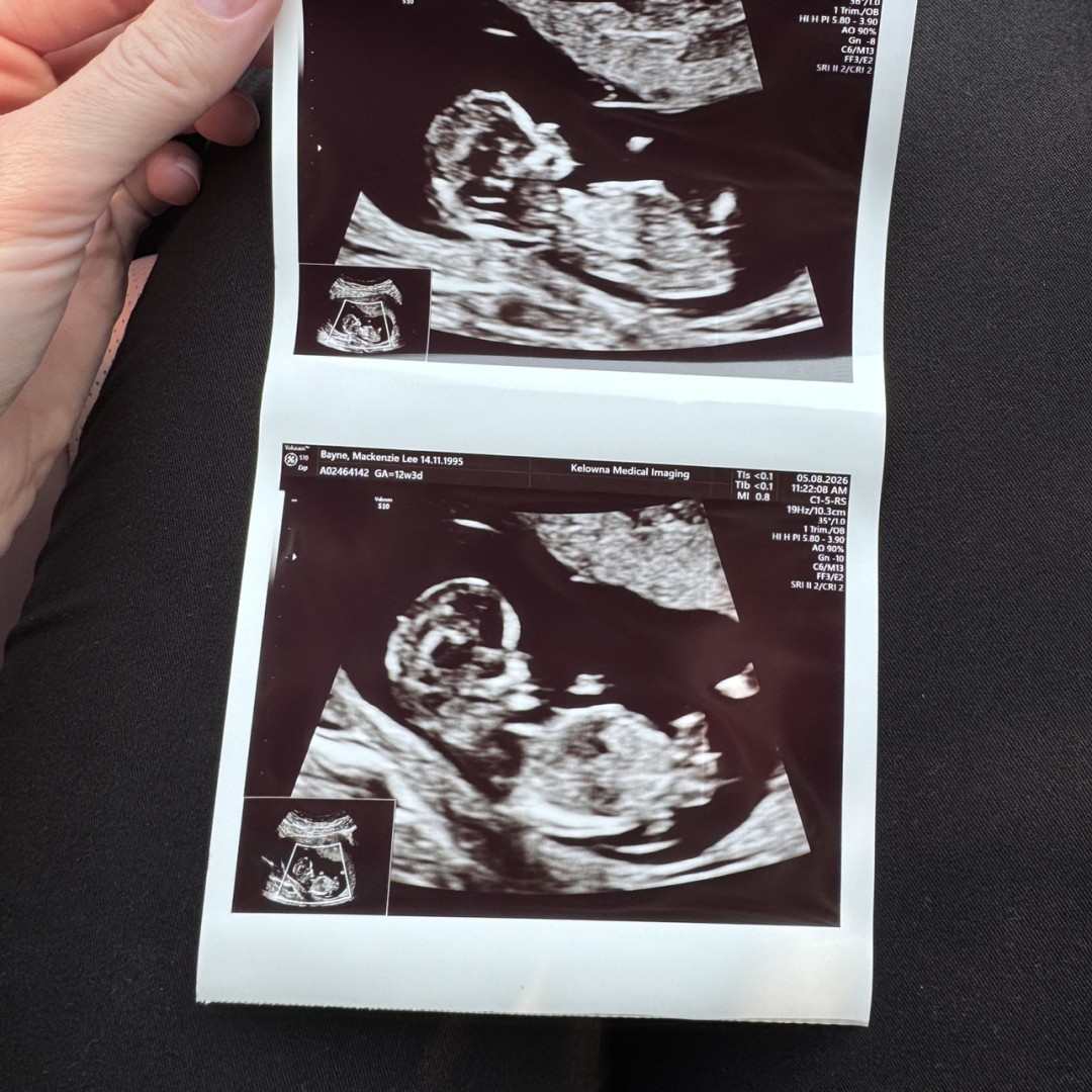 Photo shared by Mackenzie for their Babylist baby registry.
