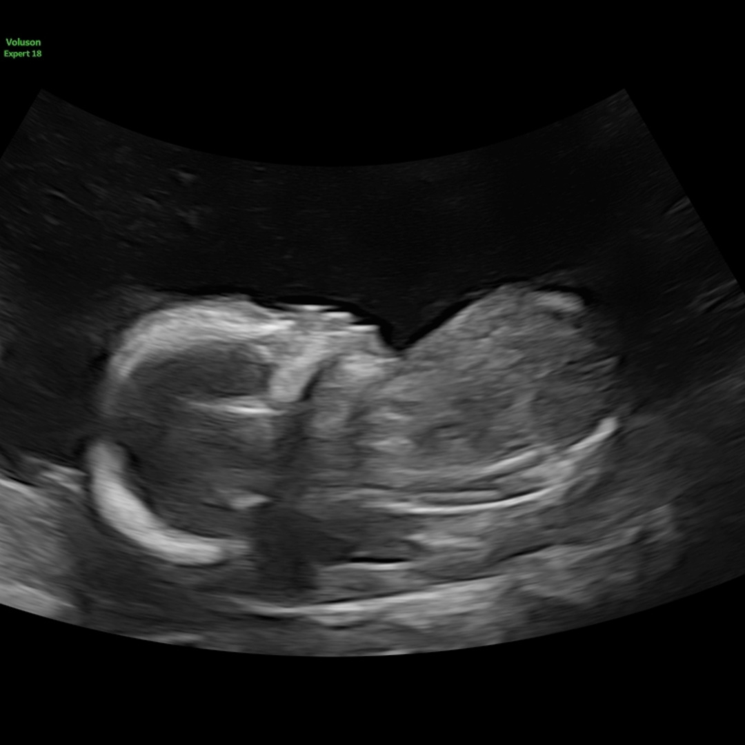 Photo shared by Alicia for their Babylist baby registry.