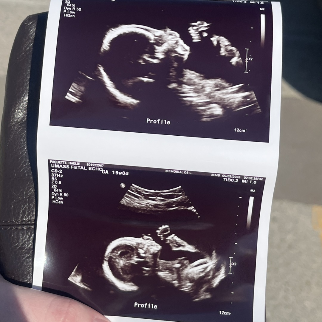 Photo shared by Haelie for their Babylist baby registry.