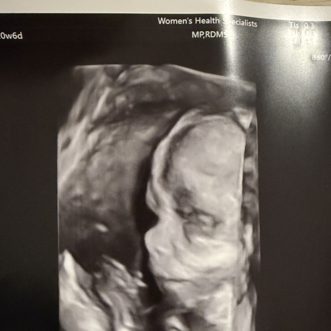 Photo shared by PJ for their Babylist baby registry.