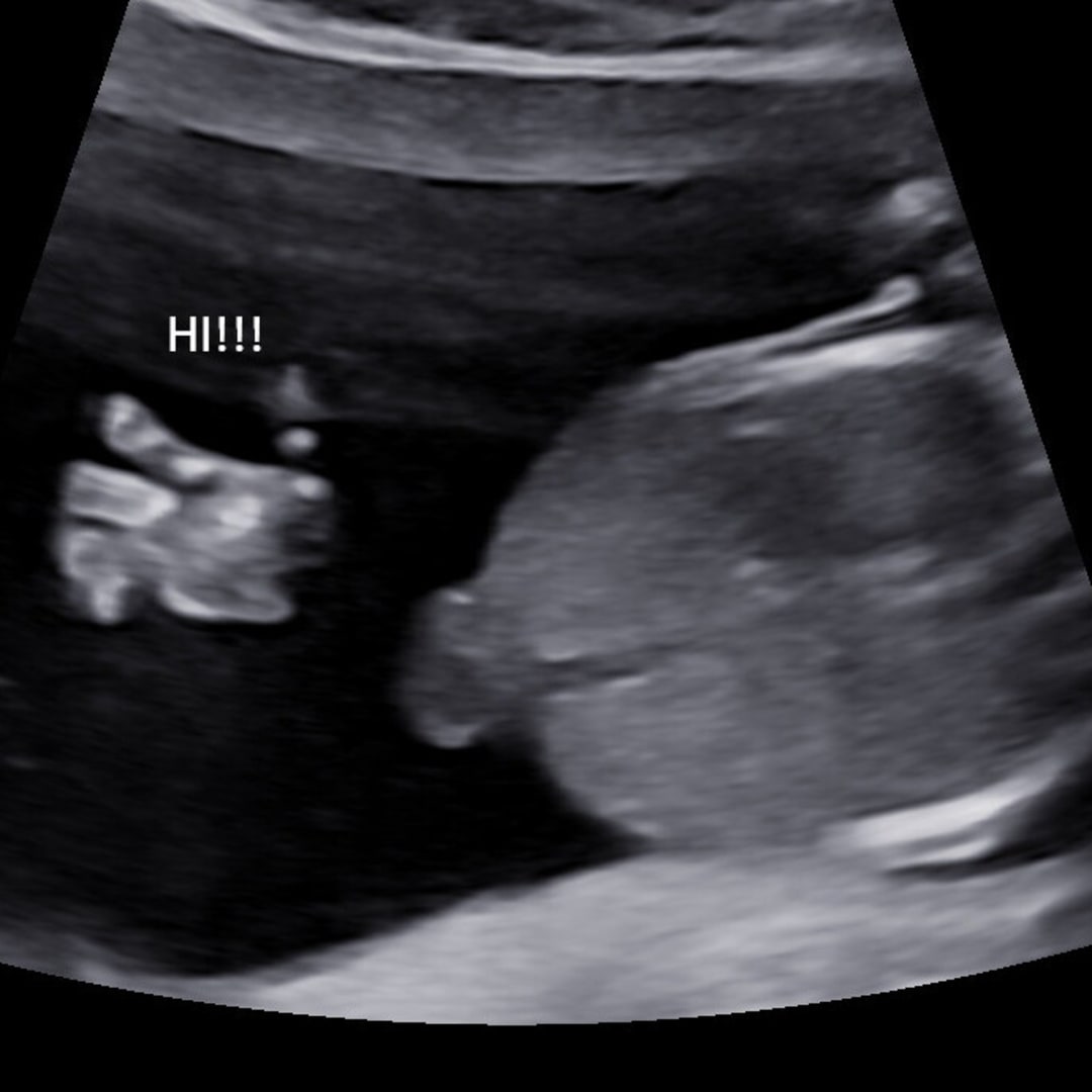 Photo shared by Elizabeth for their Babylist baby registry.