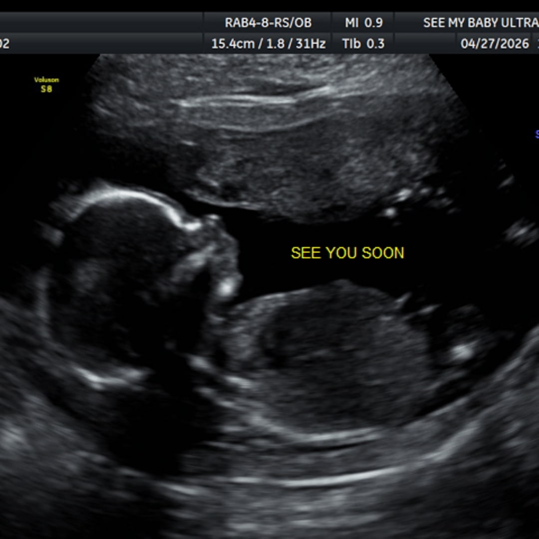 Photo shared by Amari for their Babylist baby registry.