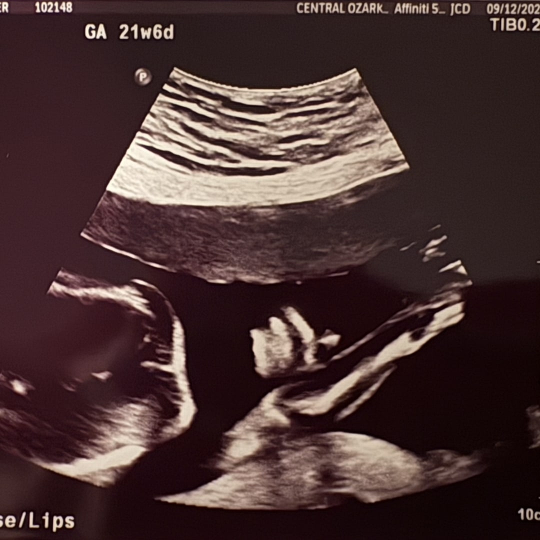 Photo shared by Jennifer for their Babylist baby registry.