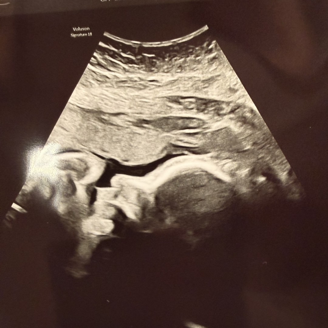 Photo shared by Andrea for their Babylist baby registry.