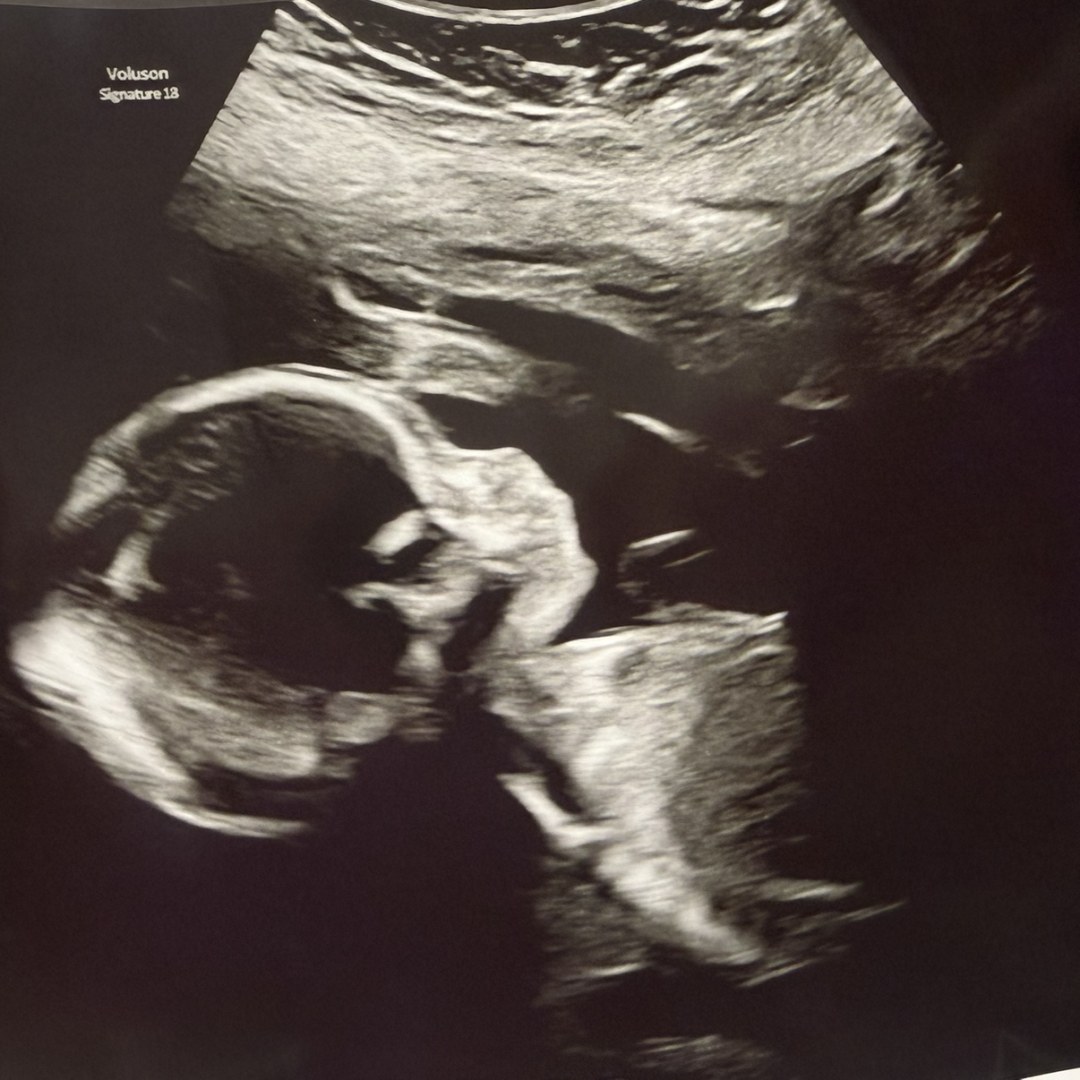 Photo shared by Katee for their Babylist baby registry.
