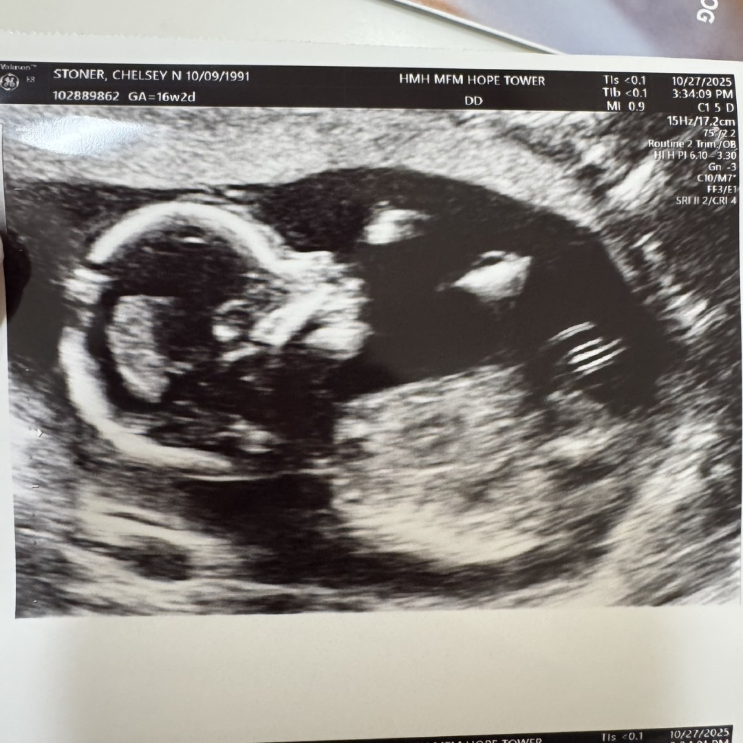 Photo shared by Chelsey for their Babylist baby registry.