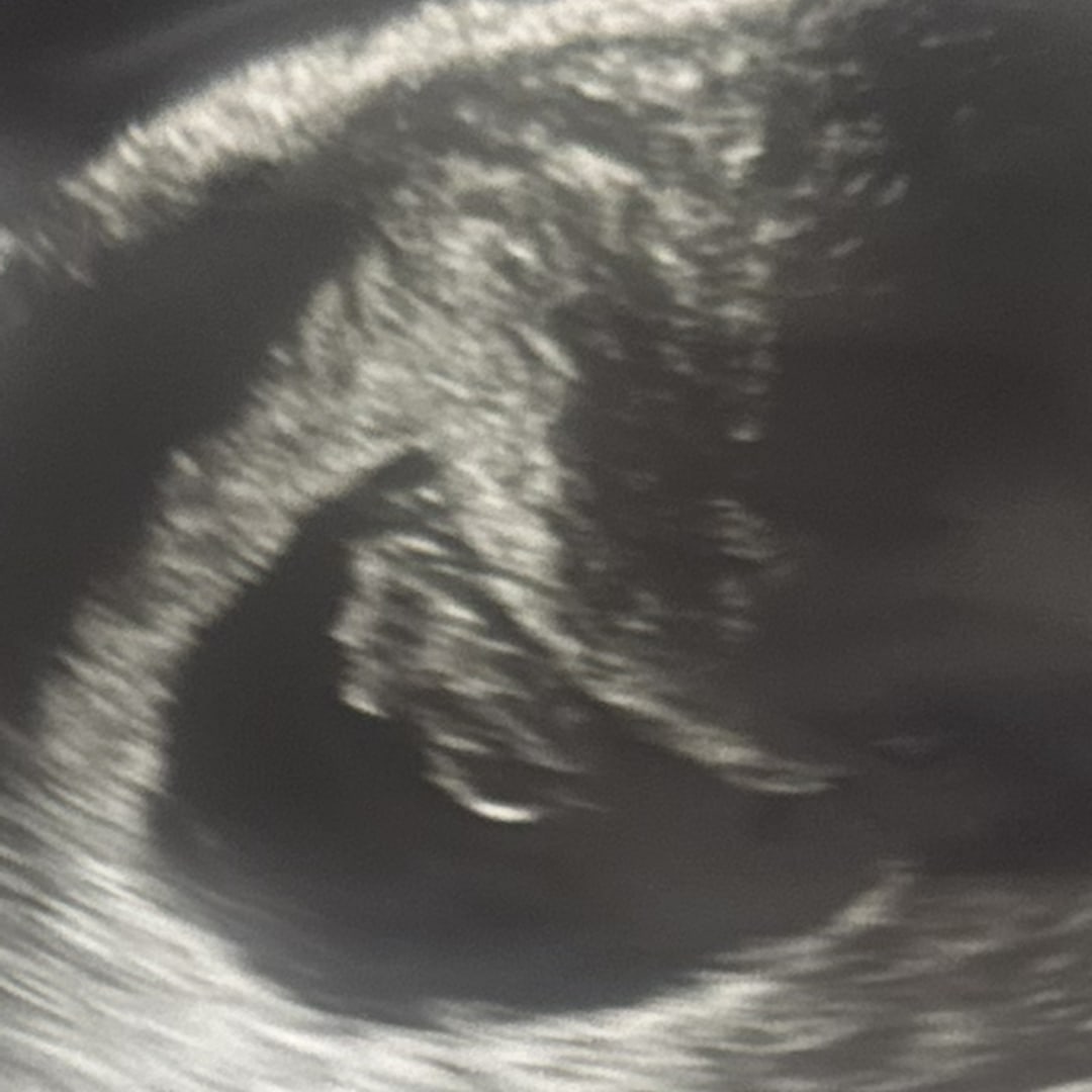 Photo shared by Jana for their Babylist baby registry.