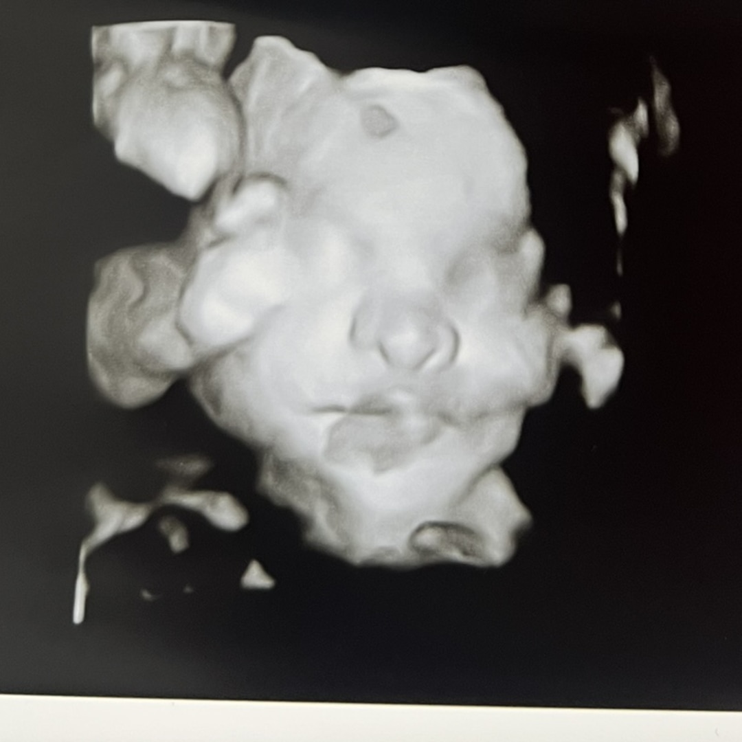 Photo shared by Briana for their Babylist baby registry.