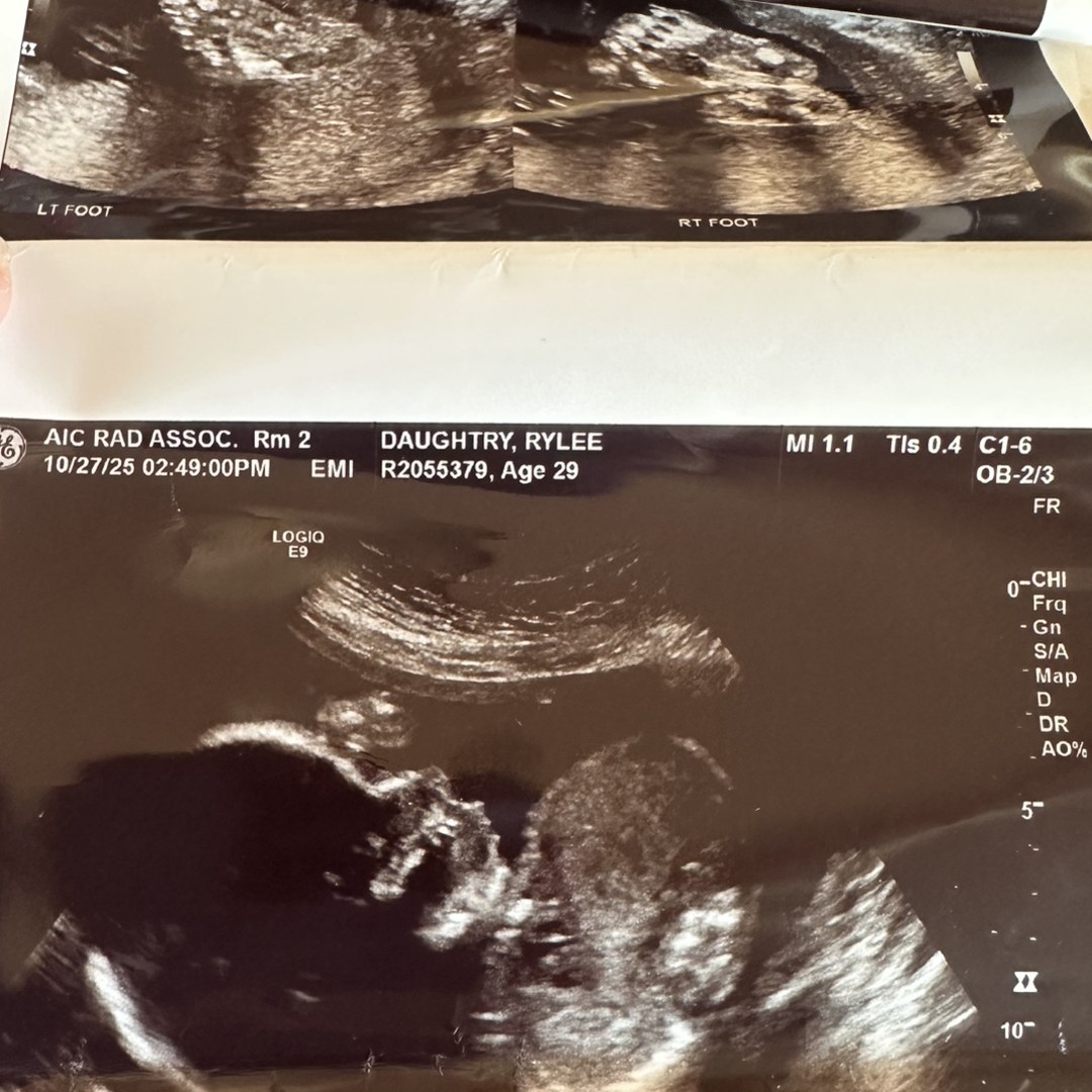 Photo shared by Rylee for their Babylist baby registry.