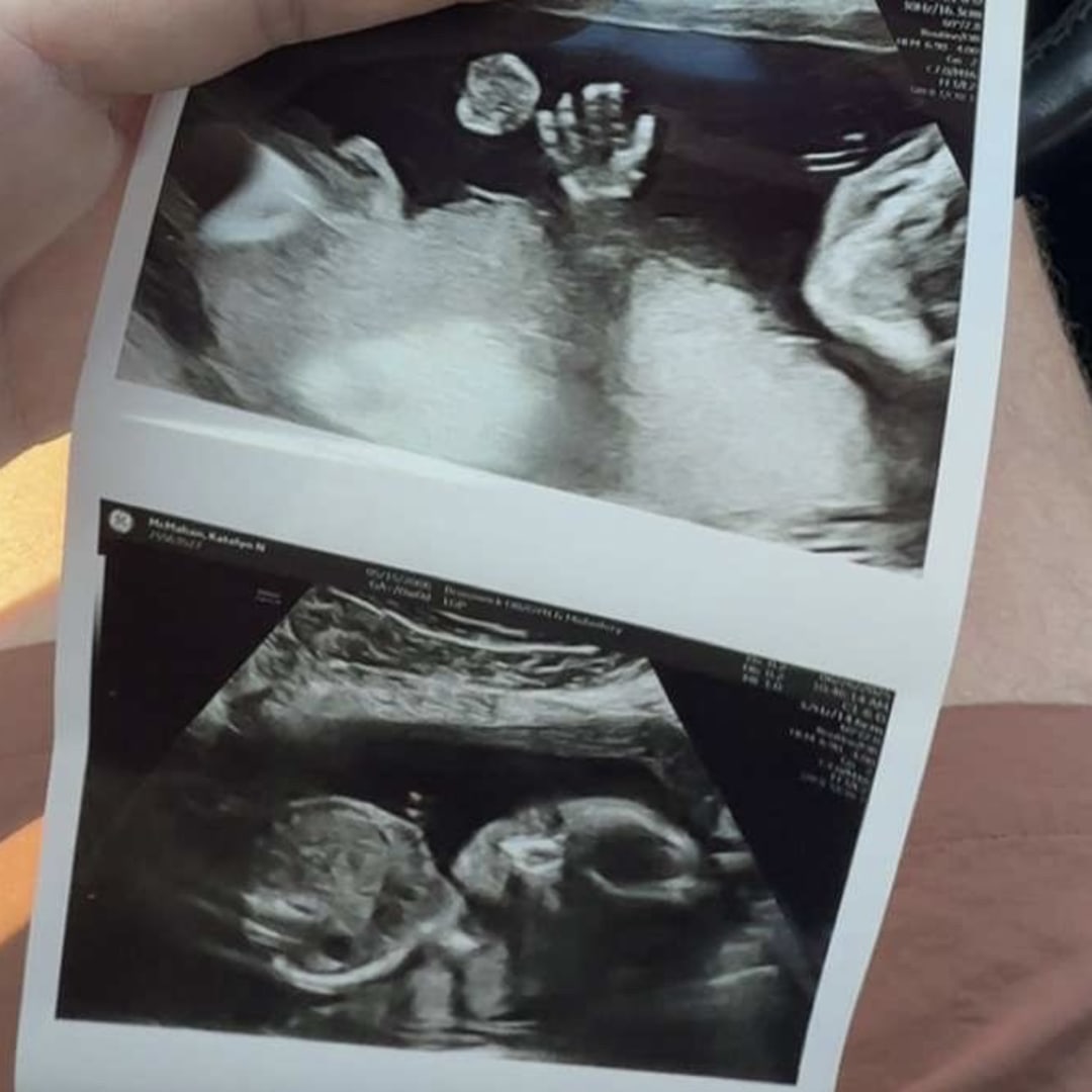 Photo shared by Katelyn for their Babylist baby registry.