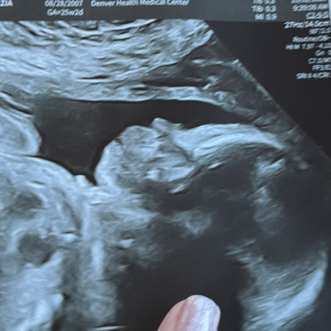 Photo shared by Miranda for their Babylist baby registry.