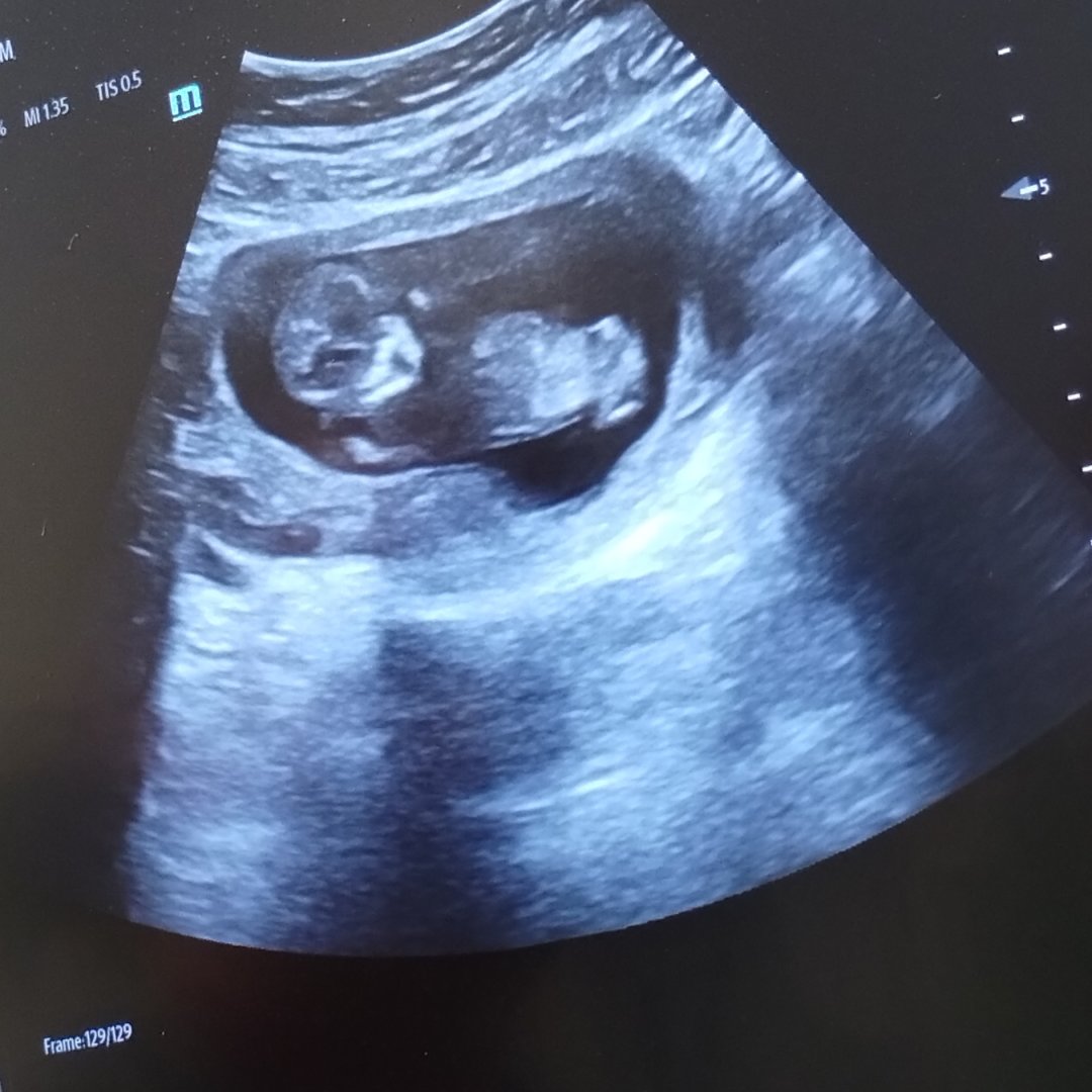 Photo shared by Ellie for their Babylist baby registry.