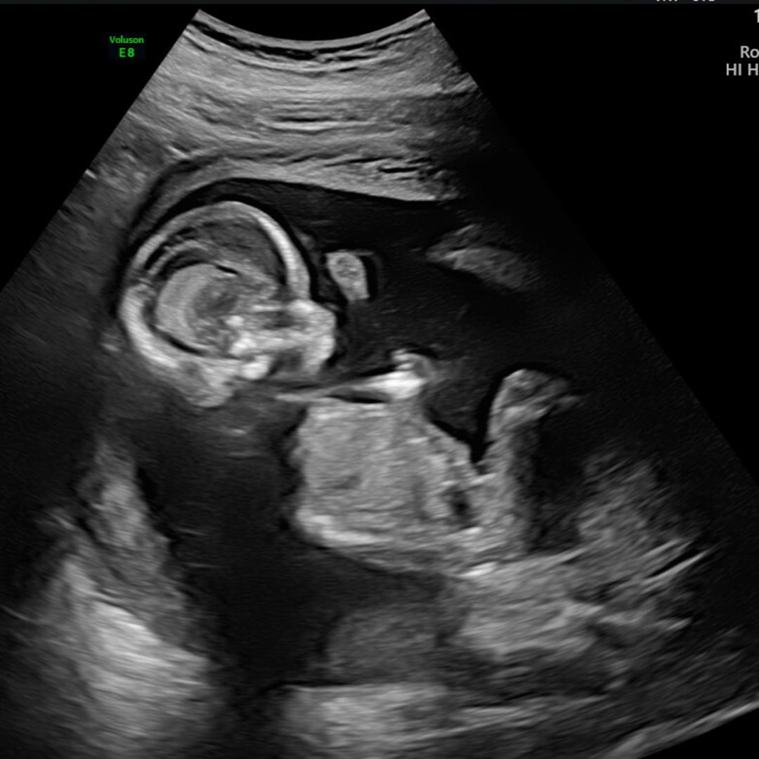Photo shared by Nesha for their Babylist baby registry.