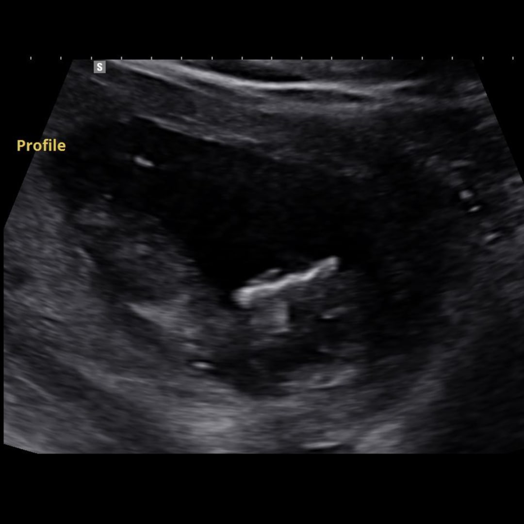 Photo shared by Crystal for their Babylist baby registry.