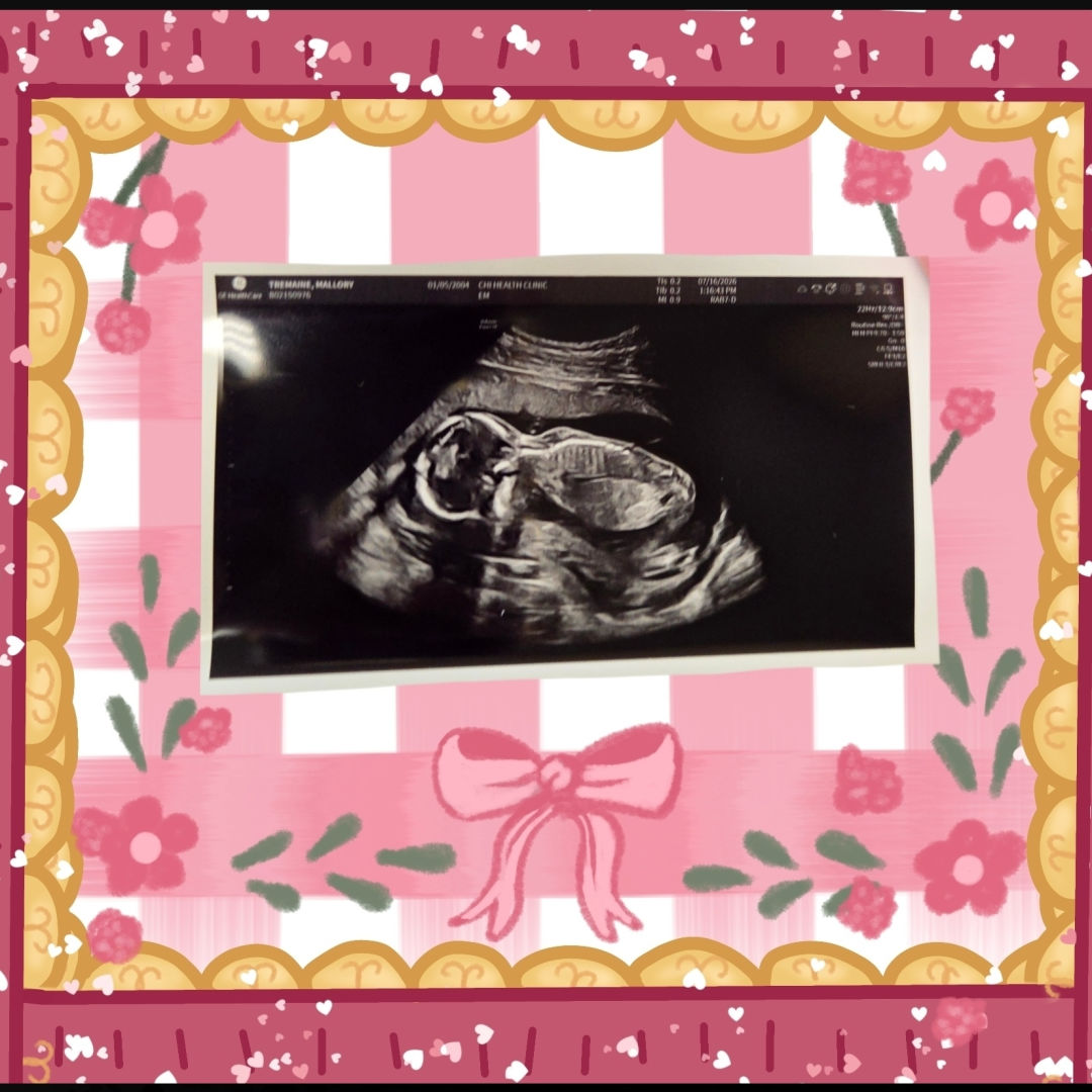 Photo shared by Mallory for their Babylist baby registry.
