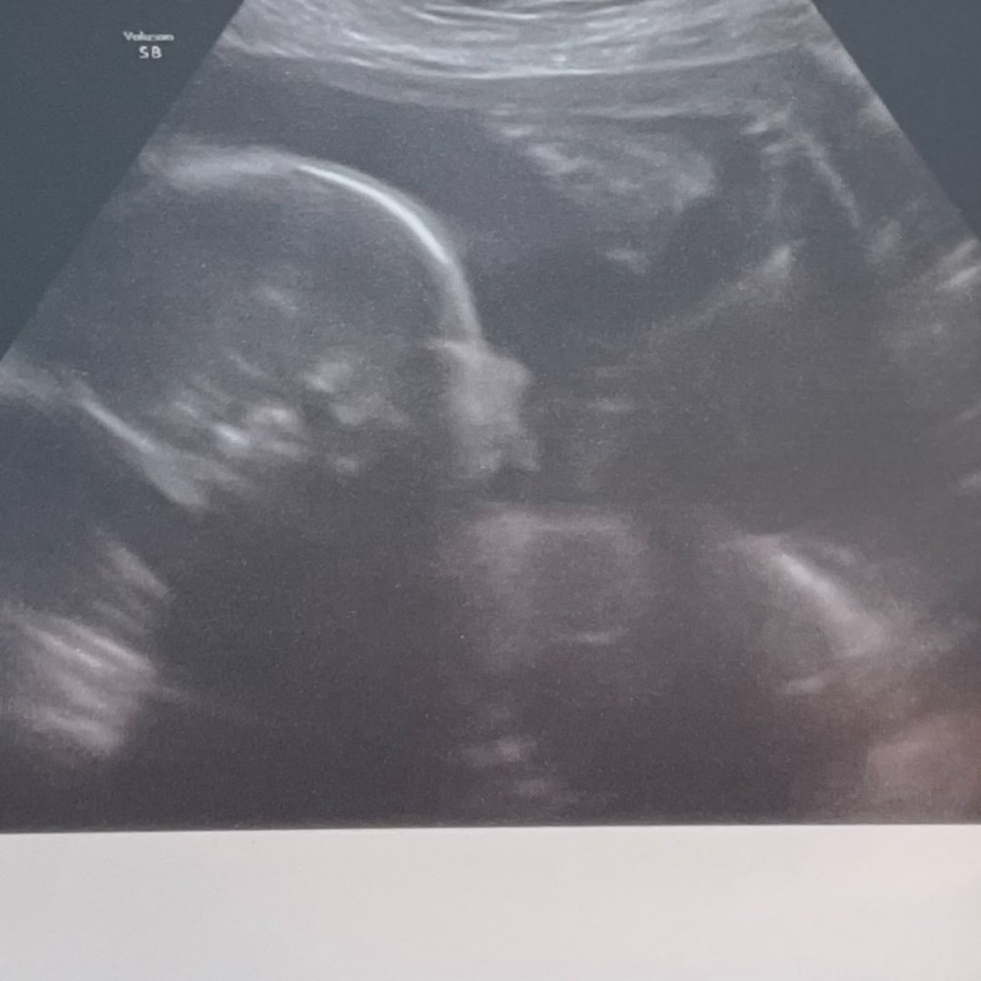 Photo shared by Haley for their Babylist baby registry.