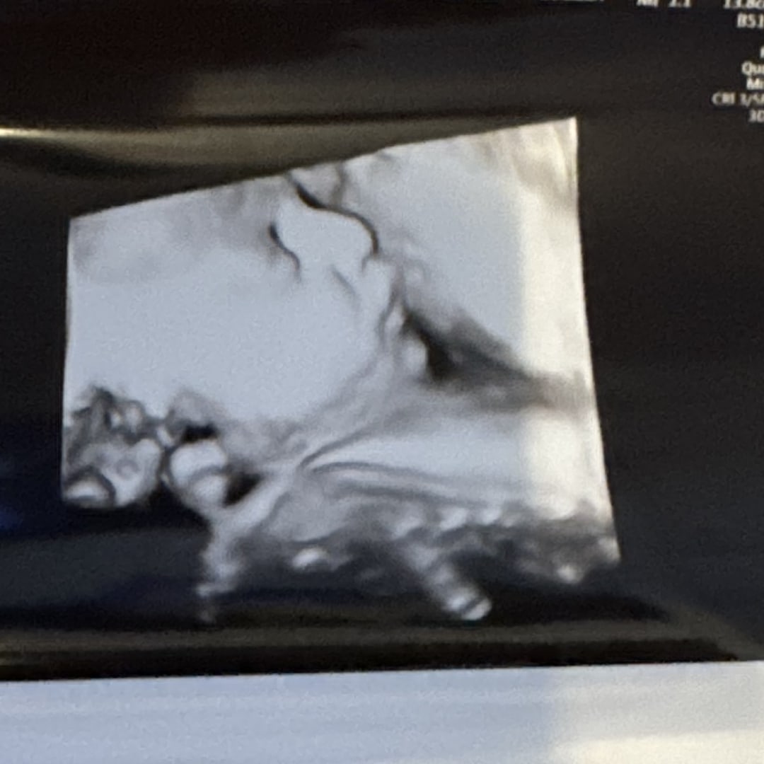 Photo shared by Jenepher for their Babylist baby registry.