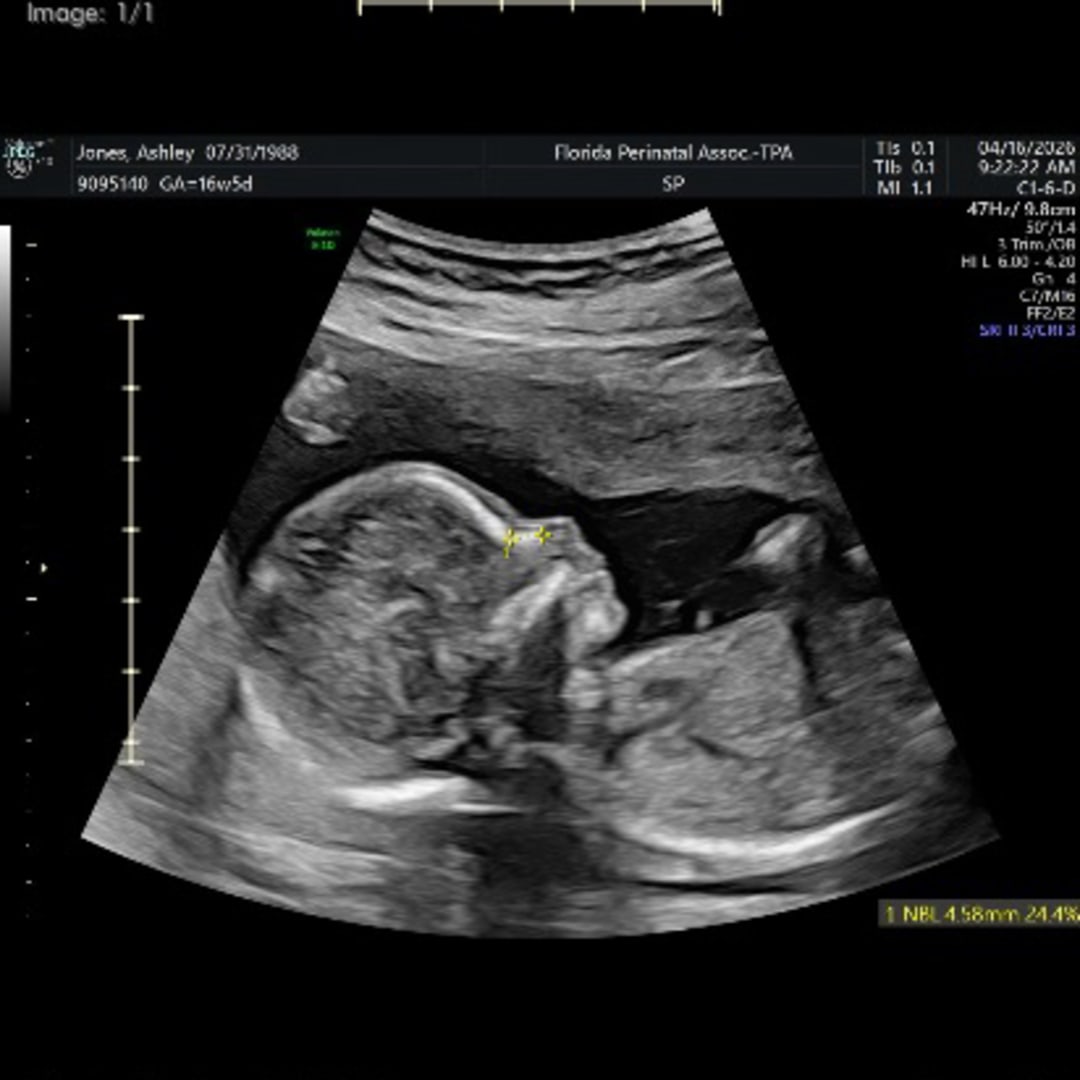 Photo shared by Ashley for their Babylist baby registry.