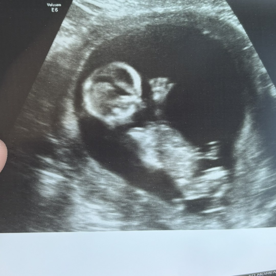 Photo shared by Makenzie for their Babylist baby registry.