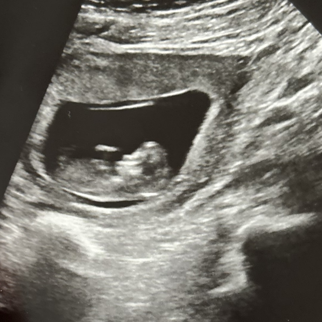 Photo shared by Yesenia for their Babylist baby registry.