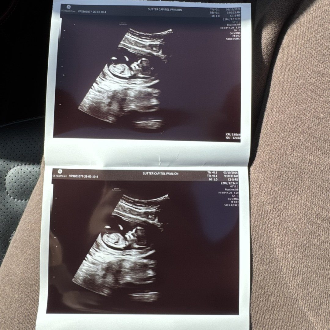 Photo shared by Aylin for their Babylist baby registry.