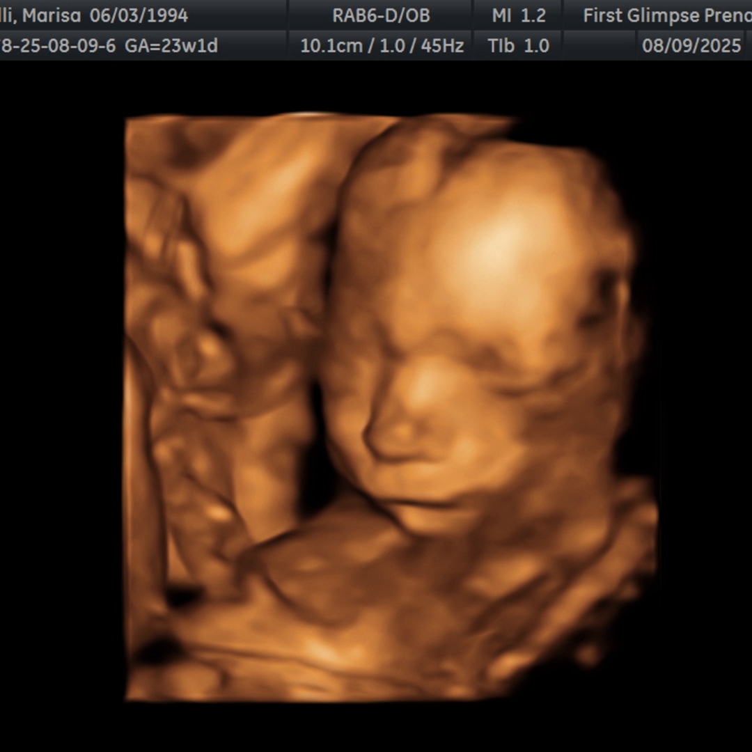 Photo shared by Marisa for their Babylist baby registry.