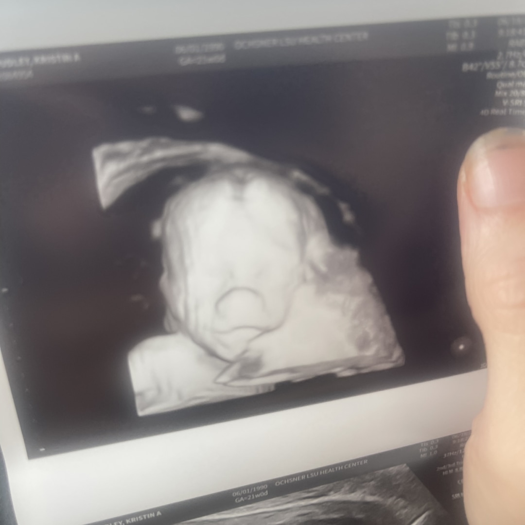 Photo shared by Kristin for their Babylist baby registry.