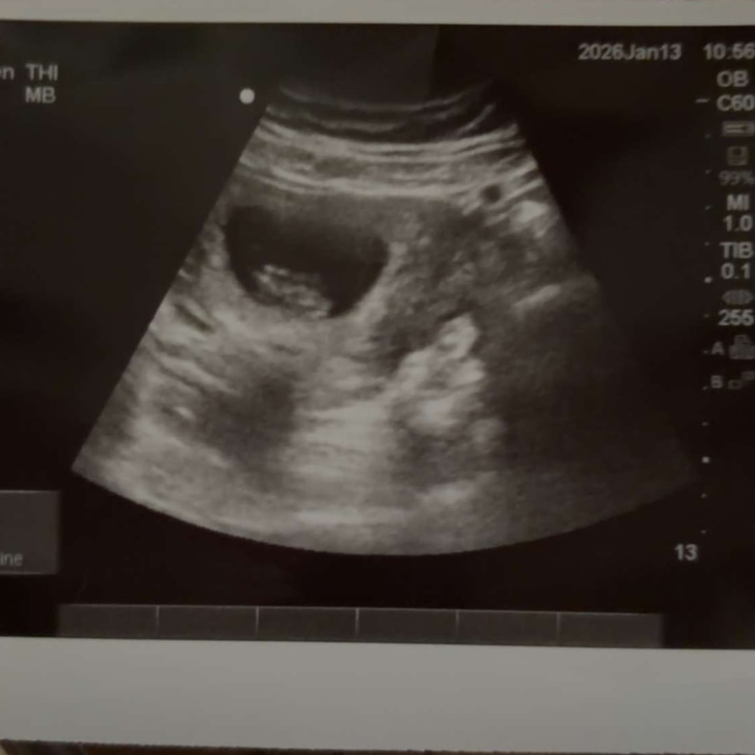 Photo shared by Ashley for their Babylist baby registry.