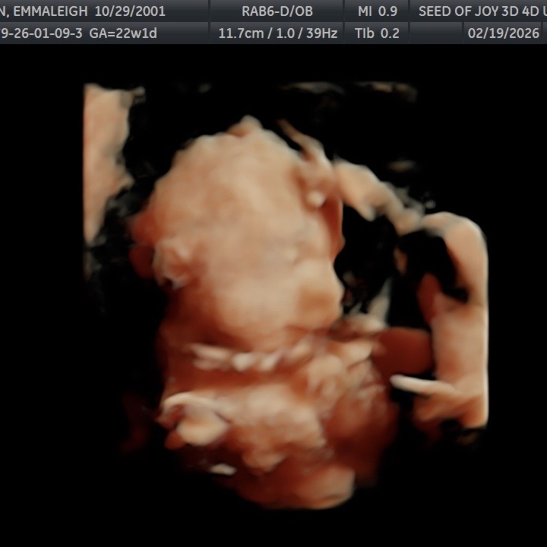 Photo shared by Gavin for their Babylist baby registry.