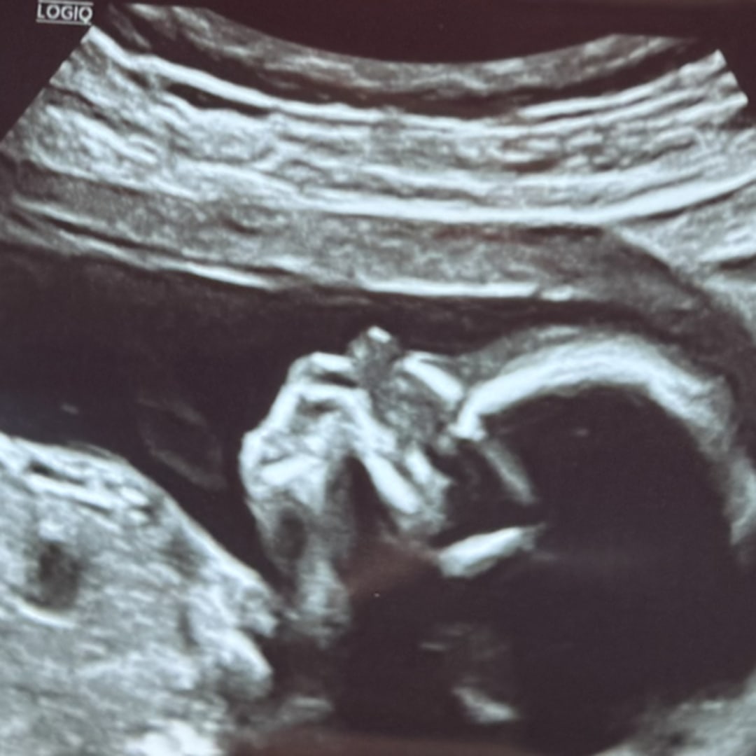 Photo shared by Viviana for their Babylist baby registry.