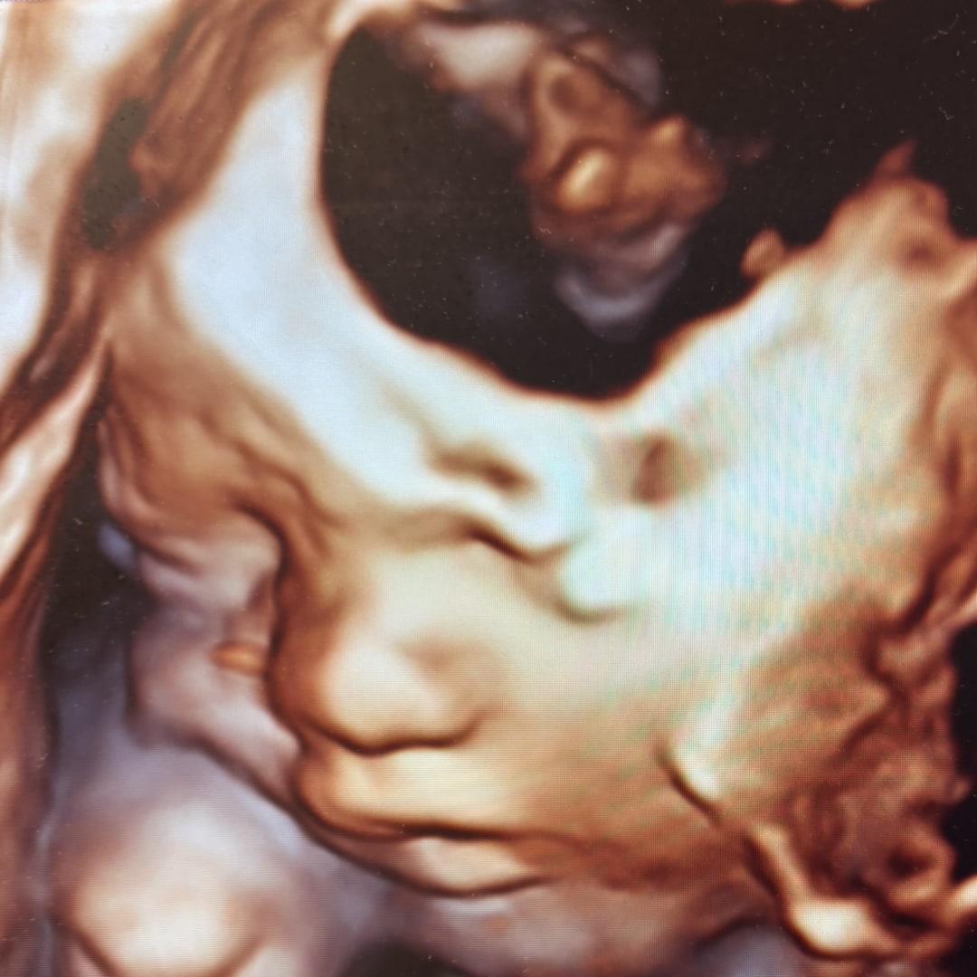 Photo shared by Christina for their Babylist baby registry.