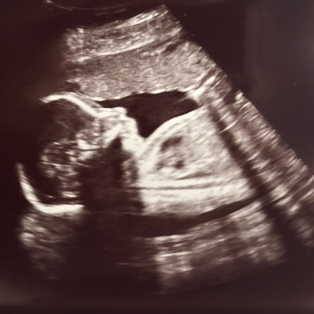 Photo shared by Stephanie for their Babylist baby registry.