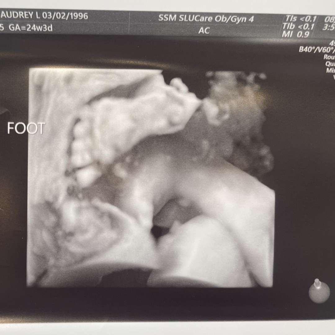 Photo shared by Audrey for their Babylist baby registry.