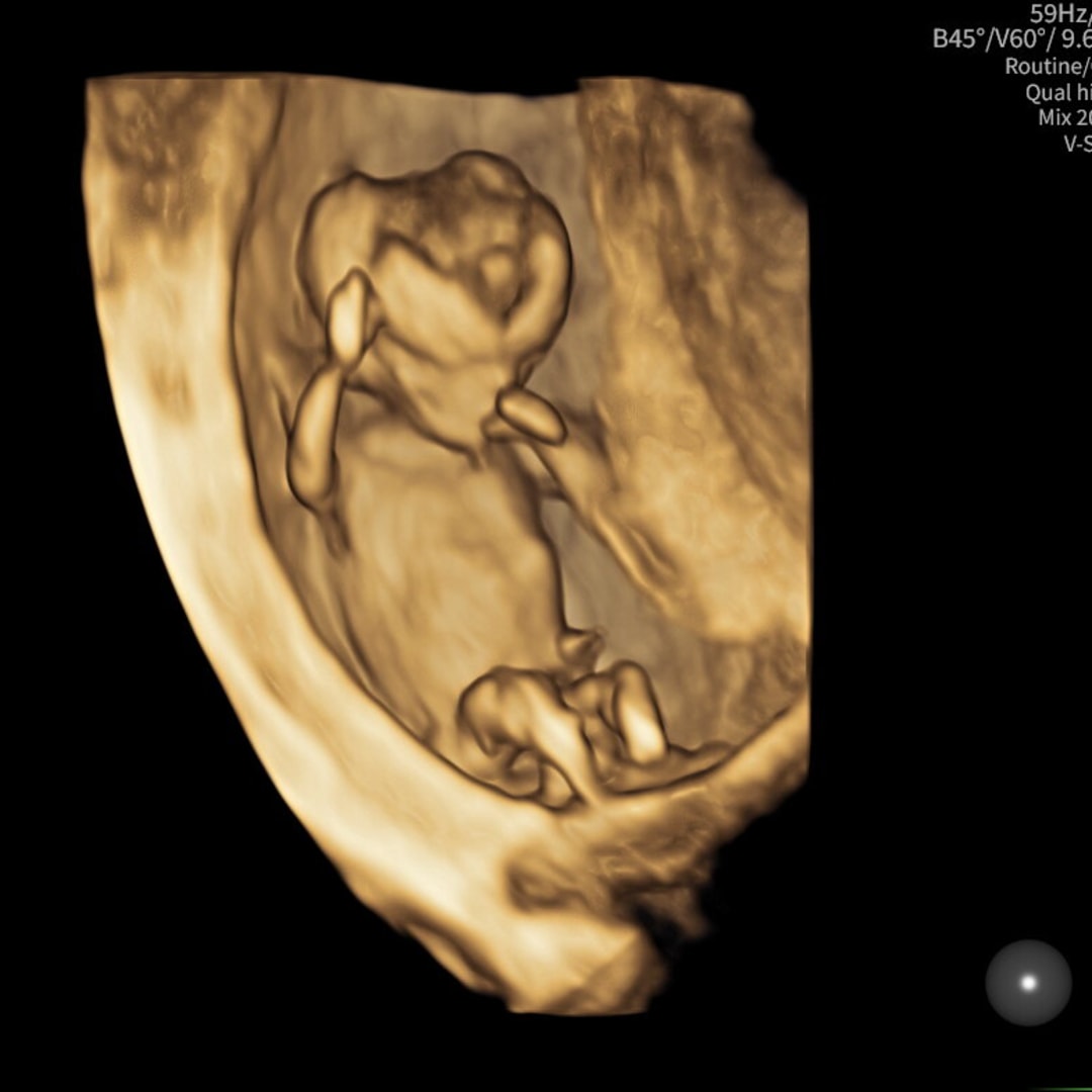 Photo shared by Chantal for their Babylist baby registry.