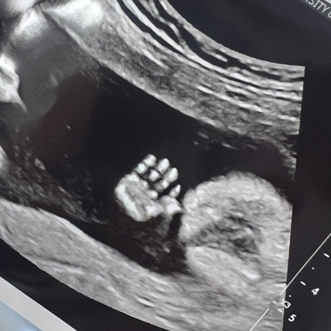 Photo shared by Marissa for their Babylist baby registry.