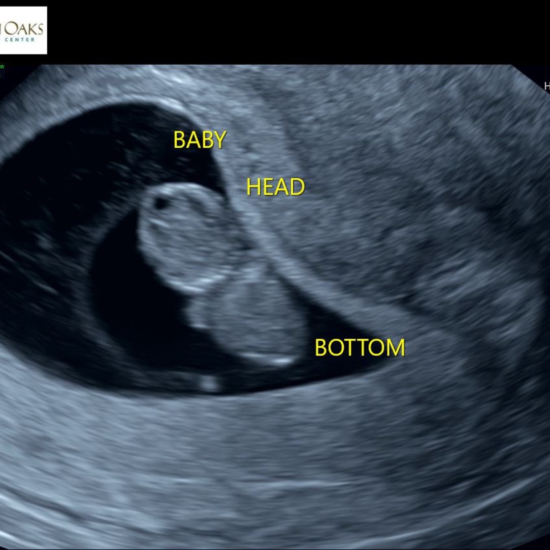 Photo shared by Mikaela for their Babylist baby registry.