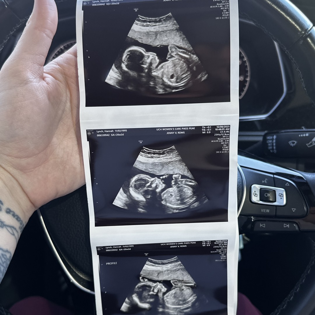 Photo shared by Hannah for their Babylist baby registry.