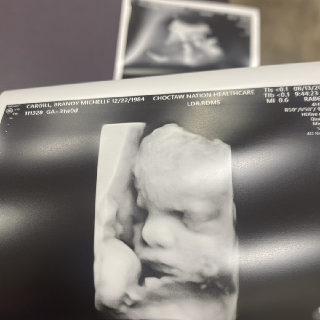 Photo shared by Brandy for their Babylist baby registry.