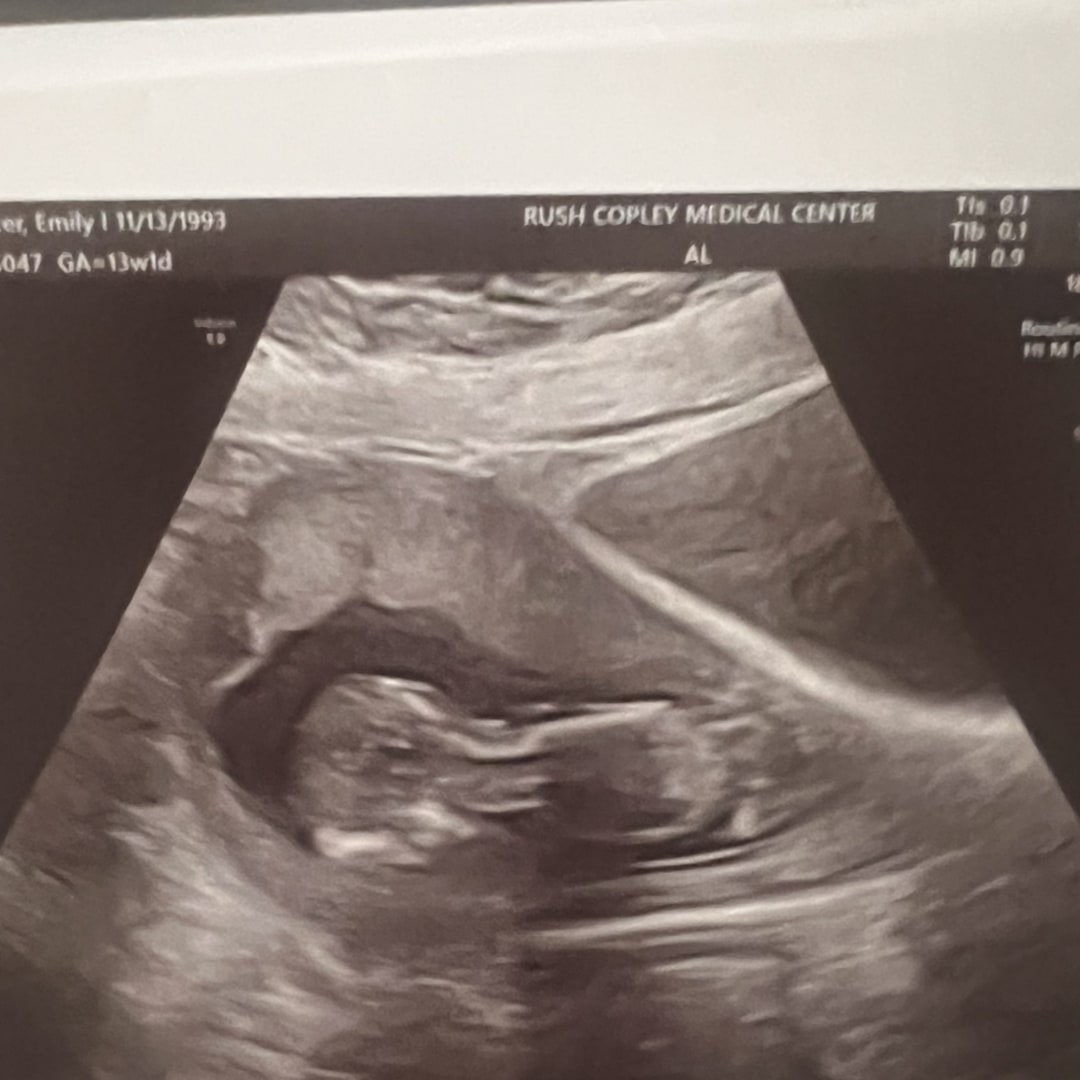 Photo shared by Emily for their Babylist baby registry.
