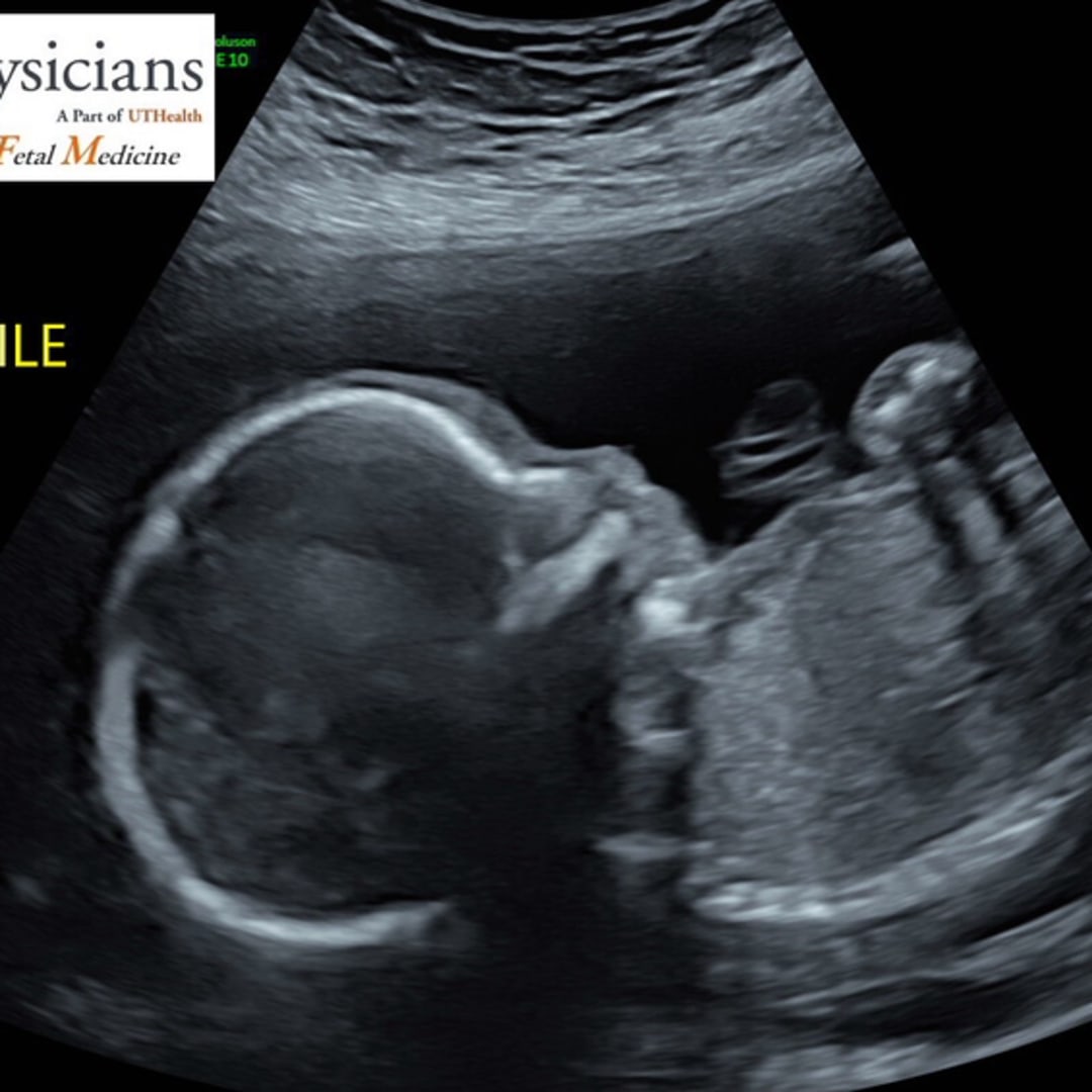 Photo shared by Jennifer for their Babylist baby registry.
