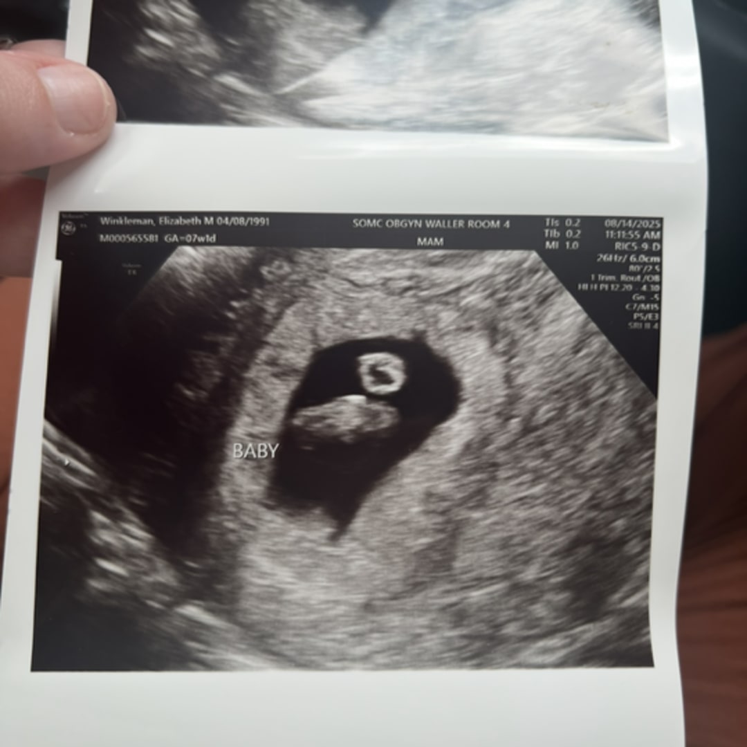 Photo shared by Liz for their Babylist baby registry.