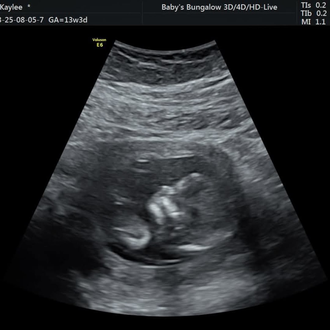 Photo shared by Kaylee for their Babylist baby registry.