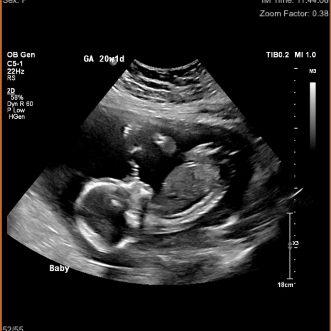 Photo shared by Hayley for their Babylist baby registry.