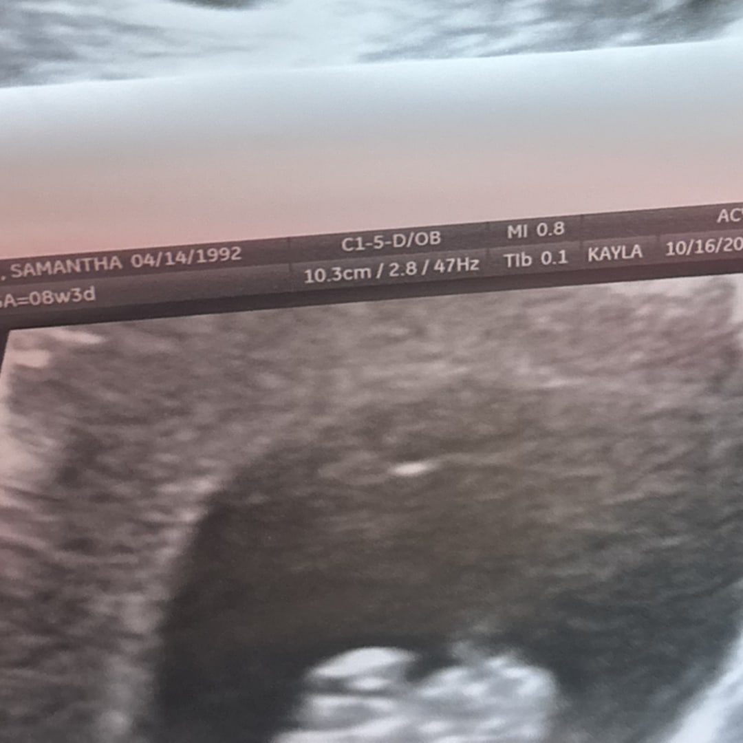 Photo shared by Samantha for their Babylist baby registry.