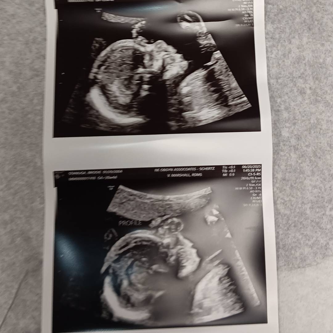 Photo shared by Brodie for their Babylist baby registry.