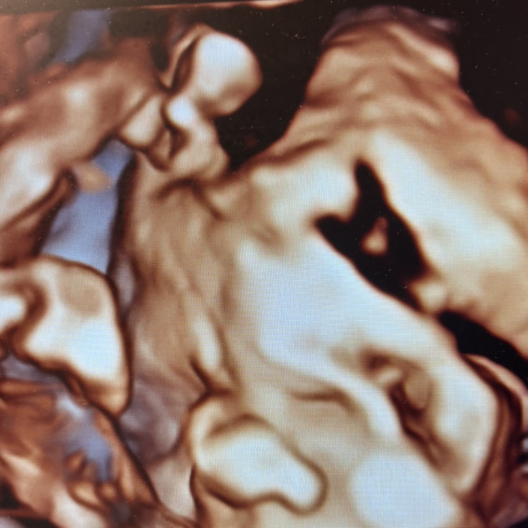 Photo shared by Christina for their Babylist baby registry.