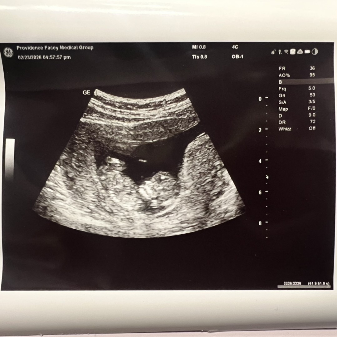 Photo shared by Maysen for their Babylist baby registry.