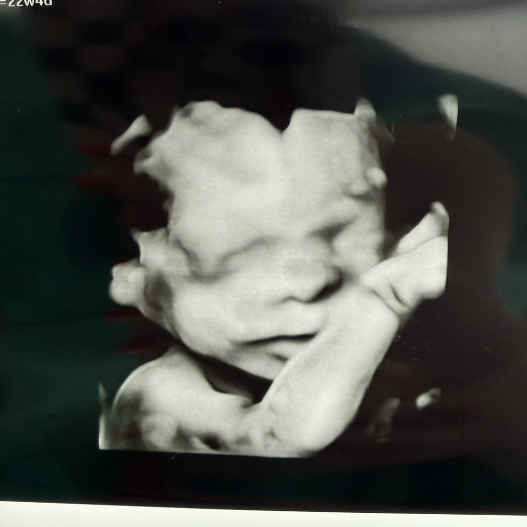Photo shared by Staci for their Babylist baby registry.