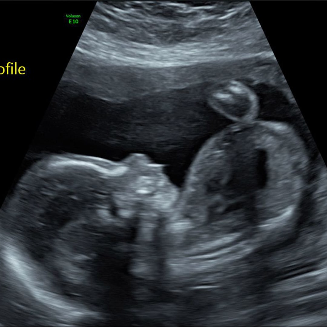 Photo shared by Alexandra for their Babylist baby registry.